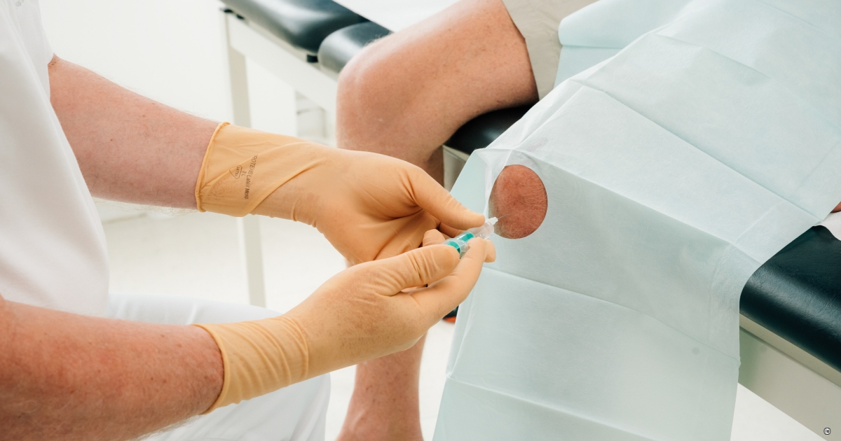 Hyaluron bei Arthrose: Wie kann die „Gelenkspritze“ helfen?